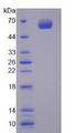CYP1A1 Protein - Recombinant Cytochrome P450 1A1 By SDS-PAGE