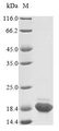 DBI / ACBD1 Protein - (Tris-Glycine gel) Discontinuous SDS-PAGE (reduced) with 5% enrichment gel and 15% separation gel.