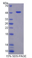 DKK3 Protein - Recombinant Dickkopf Related Protein 3 By SDS-PAGE