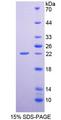EREG / Epiregulin Protein - Recombinant Epiregulin By SDS-PAGE