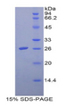 FOLR1 / Folate Receptor Alpha Protein - Recombinant Folate Receptor 1, Adult By SDS-PAGE