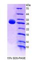 GSTM4-4 / GSTM4 Protein - Recombinant  Glutathione S Transferase Mu 4 By SDS-PAGE