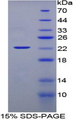 IFNA / Interferon Alpha Protein - Recombinant Interferon Alpha By SDS-PAGE