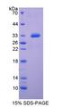 IGFBP4 Protein - Recombinant  Insulin Like Growth Factor Binding Protein 4 By SDS-PAGE