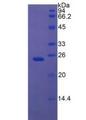 IGFBP7 / TAF Protein - Recombinant Insulin Like Growth Factor Binding Protein 7 By SDS-PAGE