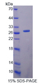 ITGAL / CD11a Protein - Recombinant  Lymphocyte Function Associated Antigen 1 Alpha By SDS-PAGE