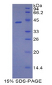 LCN9 Protein - Recombinant Lipocalin 9 By SDS-PAGE