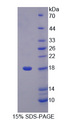 LCNL1 Protein - Recombinant Lipocalin Like Protein 1 By SDS-PAGE