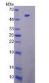 LPL / Lipoprotein Lipase Protein - Recombinant  Lipase, Lipoprotein By SDS-PAGE