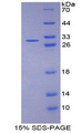 MAP1L / MAP1A Protein - Recombinant Microtubule Associated Protein 1A By SDS-PAGE