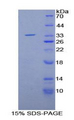 MMP7 / Matrilysin Protein - Recombinant Matrix Metalloproteinase 7 By SDS-PAGE