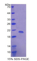 p16INK4a / CDKN2A Protein - Recombinant Cyclin Dependent Kinase Inhibitor 2A By SDS-PAGE