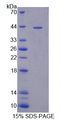 PFKL Protein - Recombinant Phosphofructokinase, Liver By SDS-PAGE