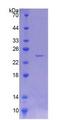 PNPLA6 / NTE Protein - Recombinant  Neuropathy Target Esterase By SDS-PAGE