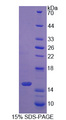 S100A16 Protein - Recombinant S100 Calcium Binding Protein A16 By SDS-PAGE