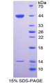 SFTPD / Surfactant Protein D Protein - Recombinant Surfactant Associated Protein D By SDS-PAGE