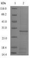 SNCA / Alpha-Synuclein Protein - (Tris-Glycine gel) Discontinuous SDS-PAGE (reduced) with 5% enrichment gel and 15% separation gel.