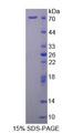 STAM2 Protein - Recombinant Signal Transducing Adaptor Molecule 2 By SDS-PAGE