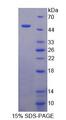 TCN2 Protein - Recombinant Transcobalamin II, Macrocytic Anemia By SDS-PAGE