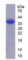 TFF3 / Trefoil Factor 3 Protein - Recombinant Trefoil Factor 3, Intestinal By SDS-PAGE