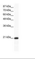 RAXL1 / RAX2 Antibody - Jurkat Cell Lysate.  This image was taken for the unconjugated form of this product. Other forms have not been tested.