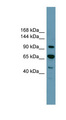 RB1 / Retinoblastoma / RB Antibody - RB1 antibody Western blot of THP-1 cell lysate. This image was taken for the unconjugated form of this product. Other forms have not been tested.