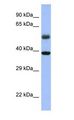 RBFOX1 / A2BP1 Antibody - RBFOX1 / A2BP1 antibody Western Blot of MCF7 cell lysate.  This image was taken for the unconjugated form of this product. Other forms have not been tested.