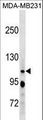 RBL1 / p107 Antibody - RBL1 Antibody western blot of MDA-MB231 cell line lysates (35 ug/lane). The RBL1 antibody detected the RBL1 protein (arrow).