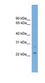 RBM11 Antibody - RBM11 antibody Western blot of 721_B cell lysate. This image was taken for the unconjugated form of this product. Other forms have not been tested.