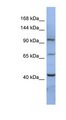 RBM12 Antibody - RBM12 antibody Western blot of HT1080 cell lysate. This image was taken for the unconjugated form of this product. Other forms have not been tested.