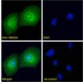 RBM20 Antibody - RBM20 antibody immunofluorescence analysis of paraformaldehyde fixed U2OS cells, permeabilized with 0.15% Triton. Primary incubation 1hr (10ug/ml) followed by Alexa Fluor 488 secondary antibody (4ug/ml), showing njuclear and Golgi apparatus staining. The nuclear stain is DAPI (blue). Negative control: Unimmunized goat IgG (10ug/ml) followed by Alexa Fluor 488 secondary antibody (4ug/ml).