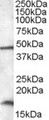 RBM3 Antibody - RBM3 antibody (0.01 ug/ml) staining of HepG2 lysate (35 ug protein/ml in RIPA buffer). Primary incubation was 1 hour. Detected by chemiluminescence.