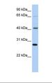 RBM34 Antibody - Hela cell lysate. Antibody concentration: 1.0 ug/ml. Gel concentration: 12%.  This image was taken for the unconjugated form of this product. Other forms have not been tested.