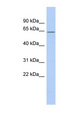 RBM40 / RNPC3 Antibody - RNPC3 antibody Western blot of Fetal Spleen lysate. This image was taken for the unconjugated form of this product. Other forms have not been tested.