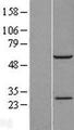 RBM42 Protein - Western validation with an anti-DDK antibody * L: Control HEK293 lysate R: Over-expression lysate