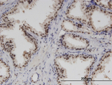 RBM6 / 3G2 Antibody - Immunoperoxidase of monoclonal antibody to RBM6 on formalin-fixed paraffin-embedded human prostate. [antibody concentration 3 ug/ml]