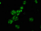 RBMS1 Antibody - Immunofluorescence staining of HepG2 cells with RBMS1 Antibody at 1:120, counter-stained with DAPI. The cells were fixed in 4% formaldehyde, permeabilized using 0.2% Triton X-100 and blocked in 10% normal Goat Serum. The cells were then incubated with the antibody overnight at 4°C. The secondary antibody was Alexa Fluor 488-congugated AffiniPure Goat Anti-Rabbit IgG(H+L).