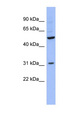 RBMS3 Antibody - RBMS3 antibody Western blot of THP-1 cell lysate. This image was taken for the unconjugated form of this product. Other forms have not been tested.