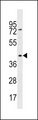 RBMXL1 Antibody - RBMXL1 Antibody western blot of HepG2 cell line lysates (35 ug/lane). The RBMXL1 antibody detected the RBMXL1 protein (arrow).