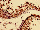 RBMY1A1 Antibody - Immunohistochemistry of paraffin-embedded human testis tissue using RBMY1A1 Antibody at dilution of 1:100
