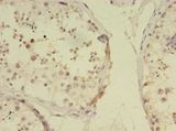 RBMY1F Antibody - Immunohistochemistry of paraffin-embedded human testis tissue using antibody at 1:100 dilution.  This image was taken for the unconjugated form of this product. Other forms have not been tested.
