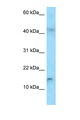 RBP2 / CRBPII Antibody - RBP2 antibody Western blot of HepG2 Cell lysate. Antibody concentration 1 ug/ml.  This image was taken for the unconjugated form of this product. Other forms have not been tested.
