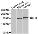 RBP3 / IRBP Antibody - Western blot analysis of extracts of various cells.