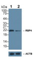 RBP4 Antibody - Knockout Varification: Lane 1: Wild-type HepG2 cell lysate; Lane 2: RBP4 knockout HepG2 cell lysate; Predicted MW: 21kDa Observed MW: 21kDa Primary Ab: 1µg/ml Rabbit Anti-Bovine RBP4 Antibody Second Ab: 0.2µg/mL HRP-Linked Caprine Anti-Rabbit IgG Polyclonal Antibody
