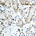 RBP5 Antibody - Immunohistochemical analysis of RBP5 staining in human kidney formalin fixed paraffin embedded tissue section. The section was pre-treated using heat mediated antigen retrieval with sodium citrate buffer (pH 6.0). The section was then incubated with the antibody at room temperature and detected using an HRP conjugated compact polymer system. DAB was used as the chromogen. The section was then counterstained with hematoxylin and mounted with DPX.