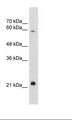 RBPJL Antibody - Jurkat Cell Lysate.  This image was taken for the unconjugated form of this product. Other forms have not been tested.