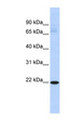 RBPMS2 Antibody - RBPMS2 antibody Western blot of Fetal Liver lysate. This image was taken for the unconjugated form of this product. Other forms have not been tested.