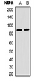 RBSN / Rabenosyn 5 Antibody - Western blot analysis of Rabenosyn 5 expression in K562 (A); HEK293T (B) whole cell lysates.