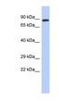 RBSN / Rabenosyn 5 Antibody - ZFYVE20 / Rabenosyn 5 antibody Western blot of Fetal Stomach lysate. This image was taken for the unconjugated form of this product. Other forms have not been tested.