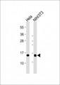RBX1 / ROC1 Antibody - All lanes: Anti-RBX1 at 1:2000 dilution Lane 1: Hela whole cell lysate Lane 2: NIH/3T3 whole cell lysate Lysates/proteins at 20 µg per lane. Secondary Goat Anti-mouse IgG, (H+L), Peroxidase conjugated at 1/10000 dilution. Predicted band size: 12 kDa Blocking/Dilution buffer: 5% NFDM/TBST.